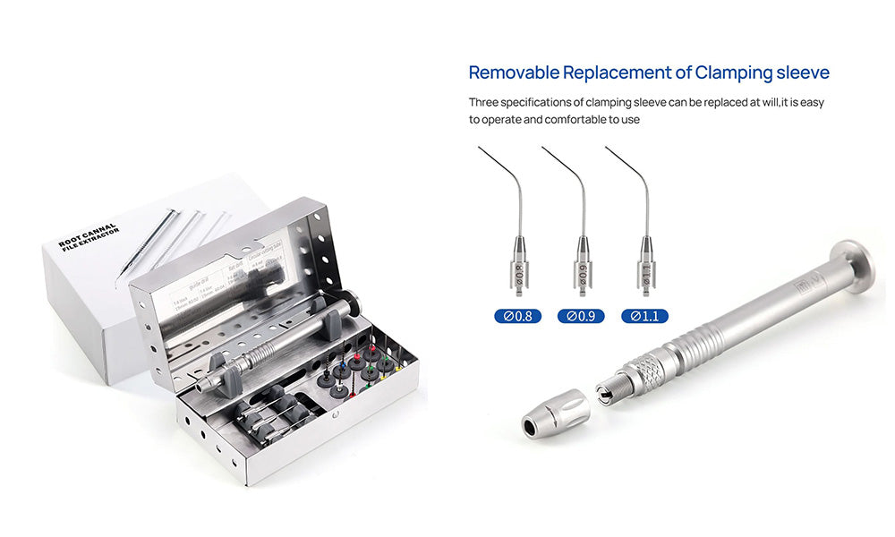  Can Innovative Extraction Systems Revolutionize Endodontic Outcomes?