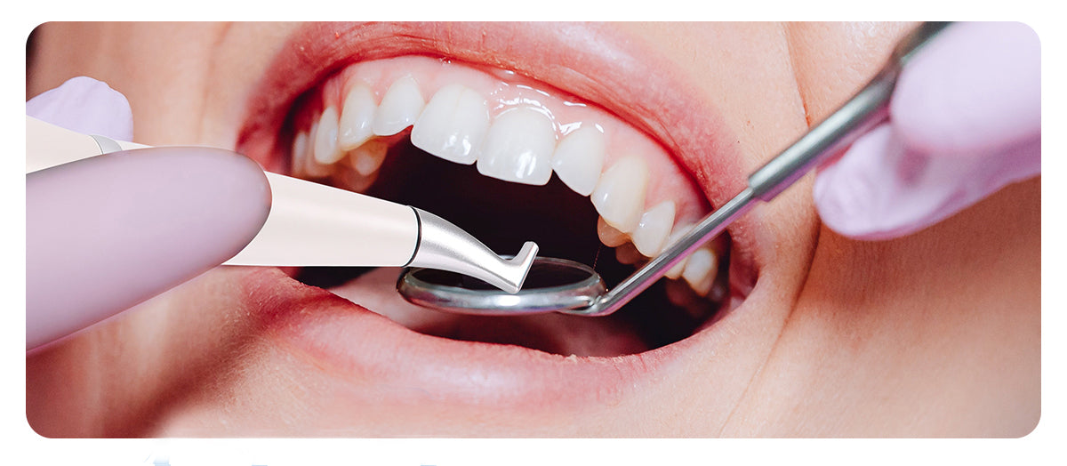 Can Air Polishing Whiten Your Teeth? - pairaydental.com