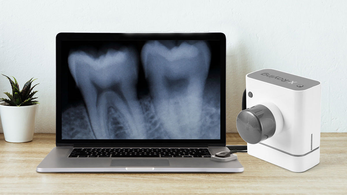 Choose the Most Suitable Dental XRays Machines