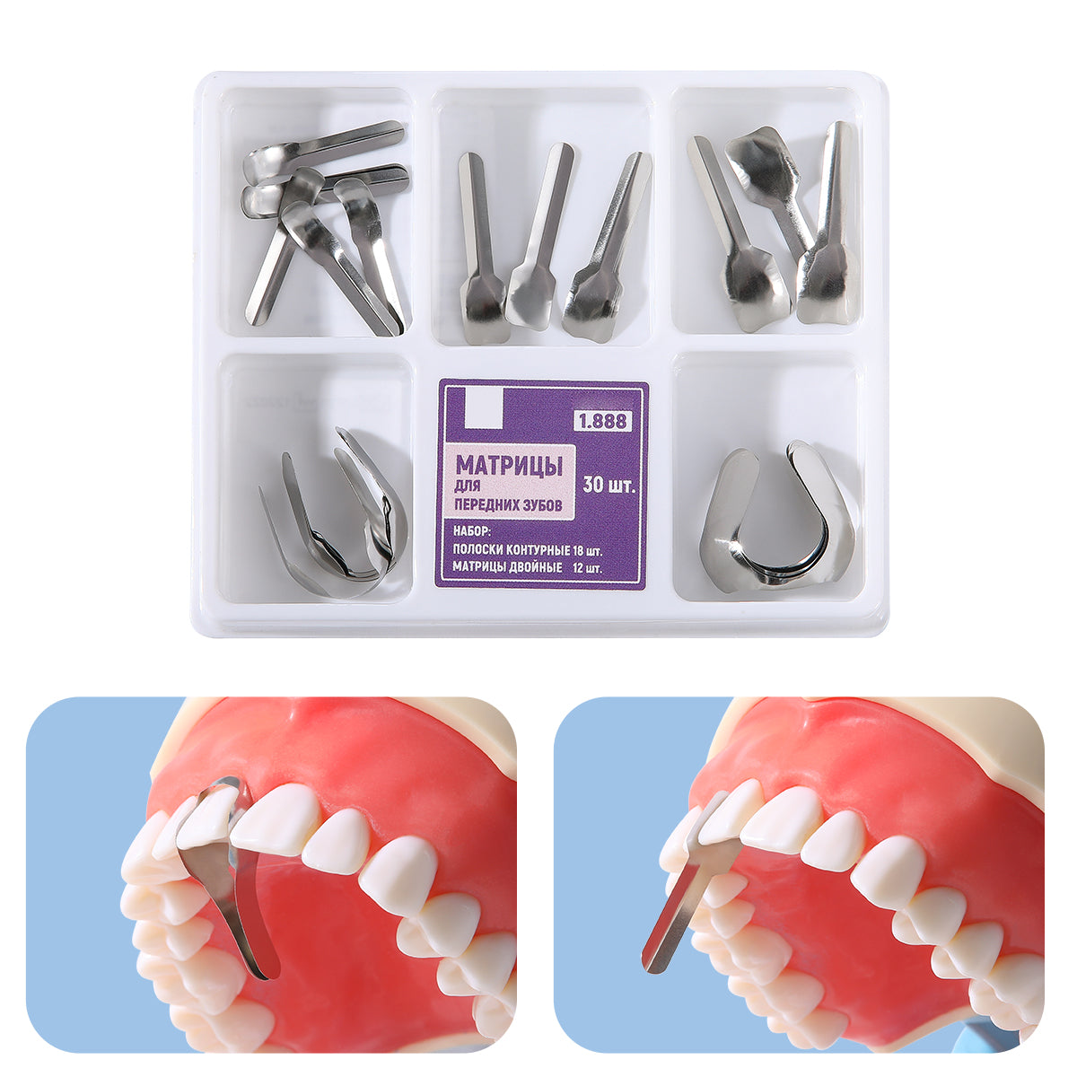 Palatal Matrix Matrix – pairaydental