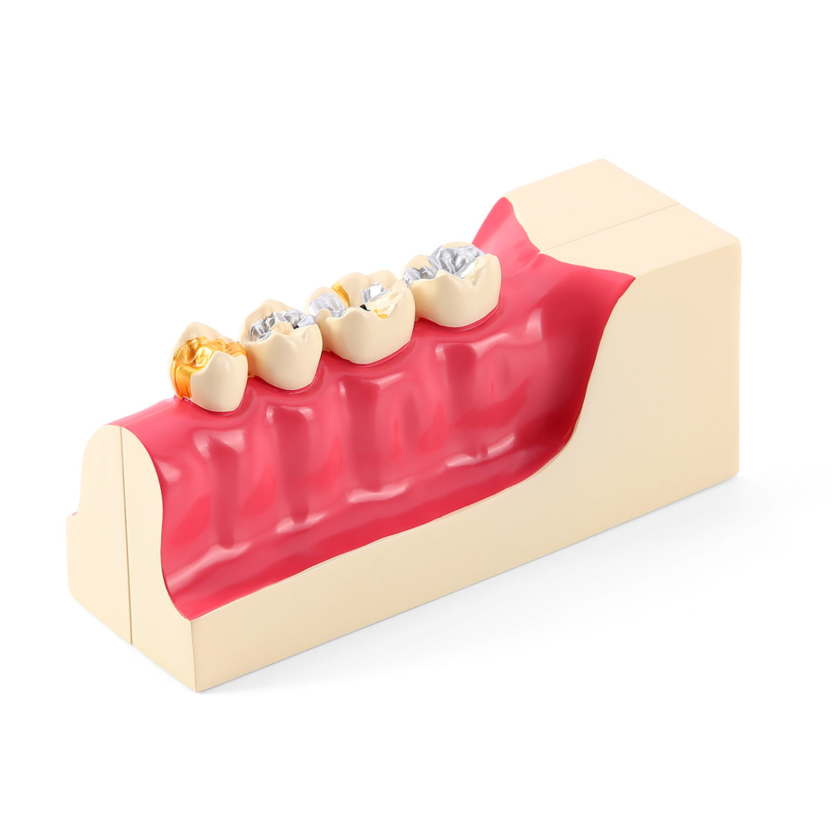 Dental Tissue Decomposition Model Right Lower Posterior Teaching Model - pairaydental.com