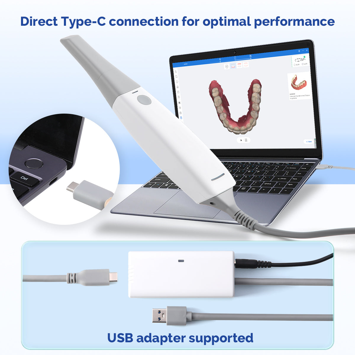 Dental Digital Impression Intraoral 3D Scanner Scanning Real Color CAD ...