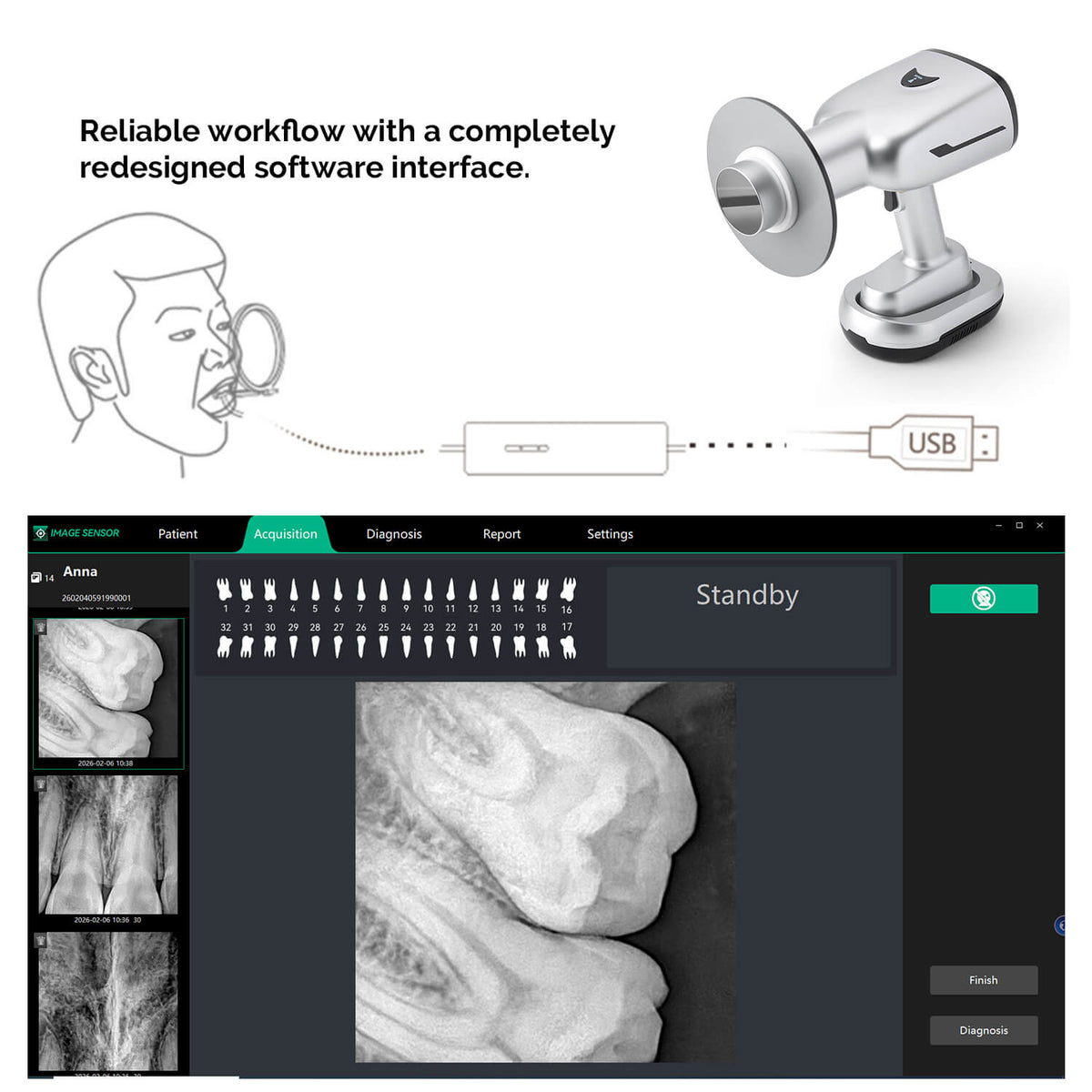Dental Digital X-Ray Sensor Intraoral Imaging System With Sensor Positioning Holder Size 1.5 XVS2530 - pairaydental.com