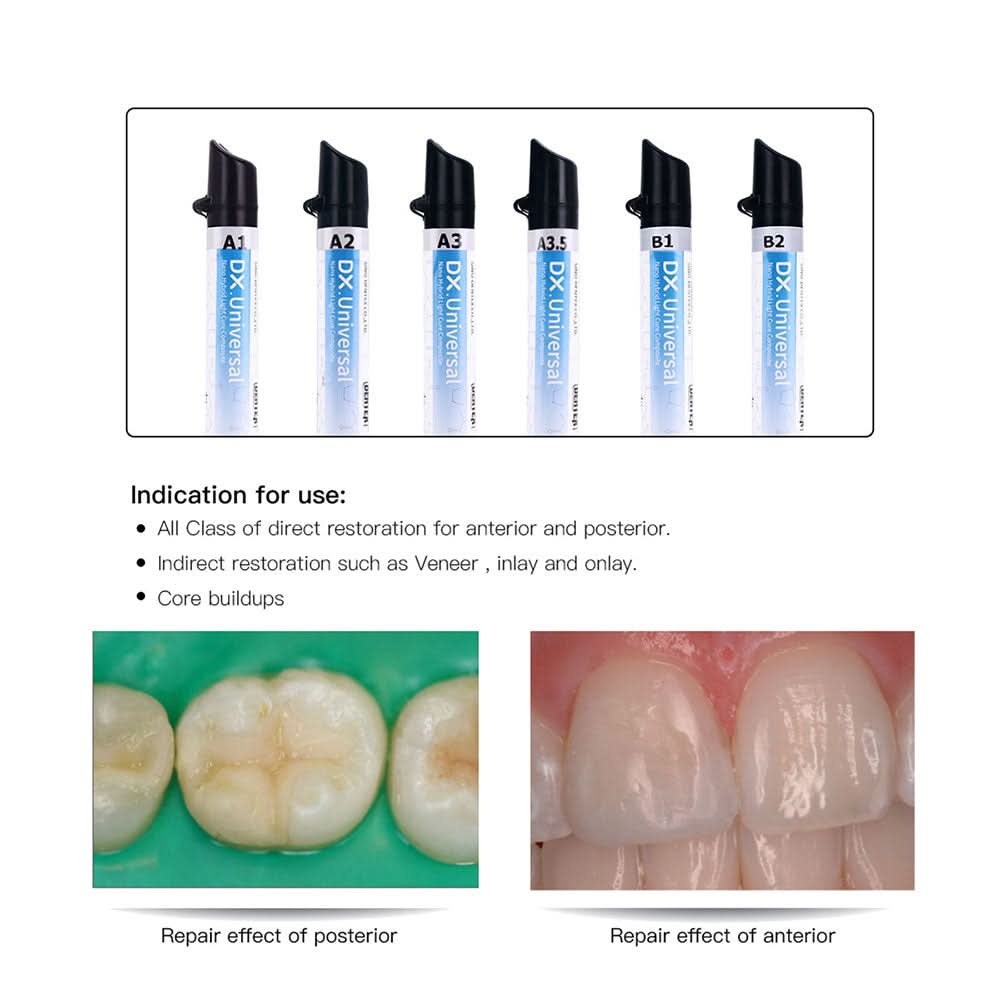 Dental Universal Light Cure Composite Resin Nano Hybrid A1/A2/A3/A3.5/B1/B2 4g/Syringe - pairaydental.com