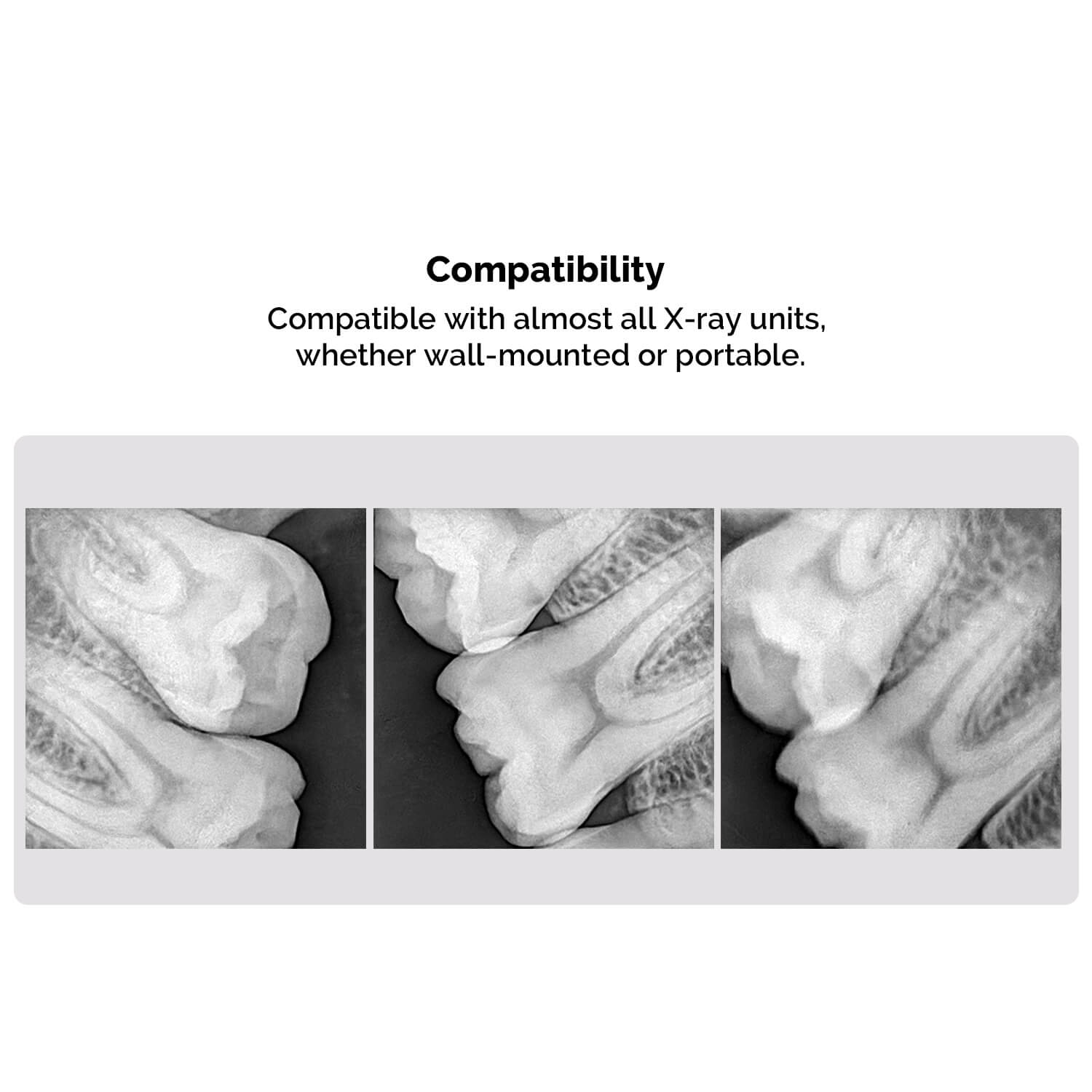 Dental Digital X-Ray Sensor Intraoral Imaging System With Sensor Positioning Holder Size 1.5 XVS2530 - pairaydental.com