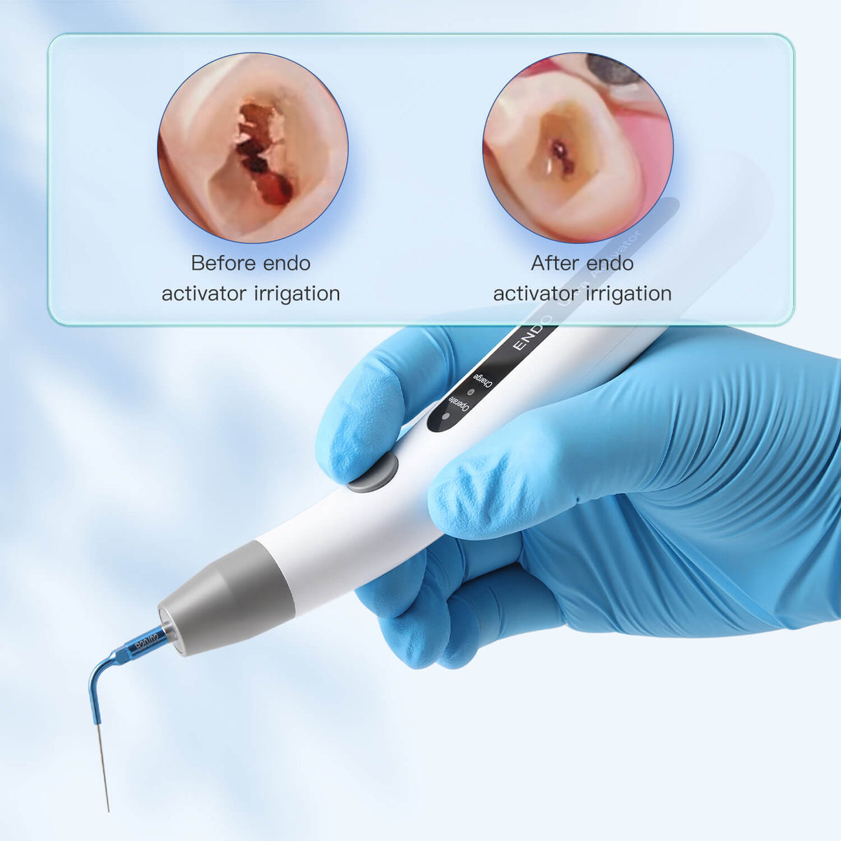 Dental Ultrasonic Activator Irrigator with 3Pcs Irrigator Tips - pairaydental.com