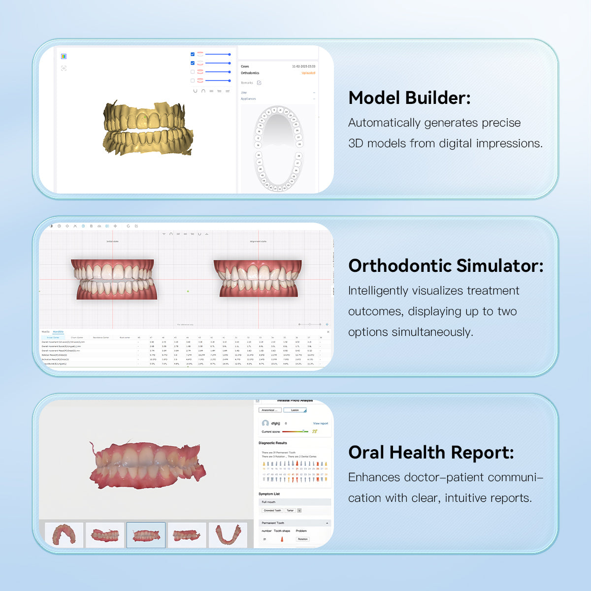 Dental Digital Impression Intraoral 3D Scanner Scanning Real Color CAD/CAM Software System - pairaydental.com