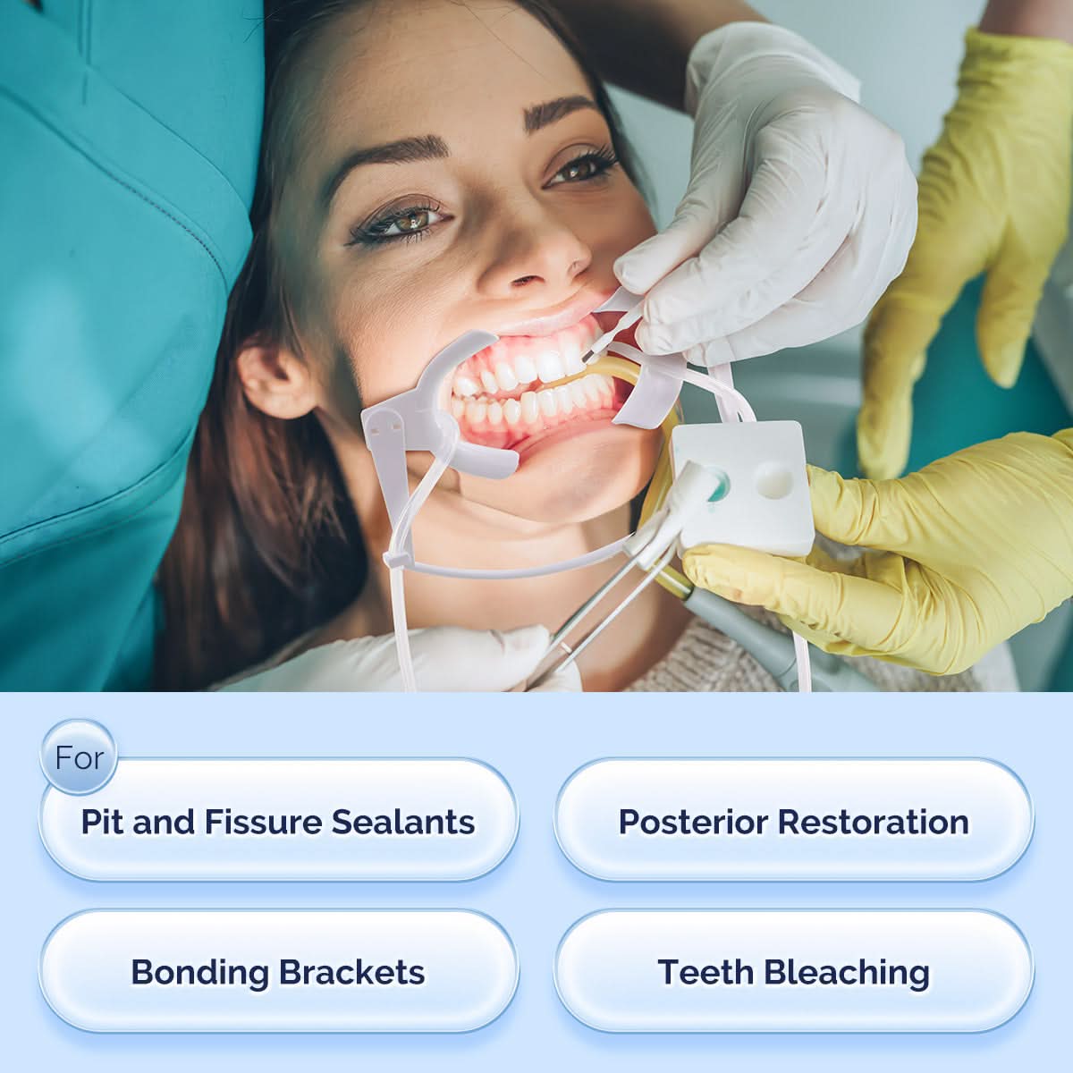Dental Ortho NOLA Cheek Retractor Dry Field System with Saliva Aspirator - pairaydental.com