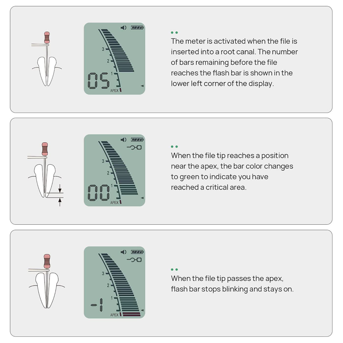 Dental Endo Apex Locator Micropex Root Canal 3.7" Screen - pairaydental.com
