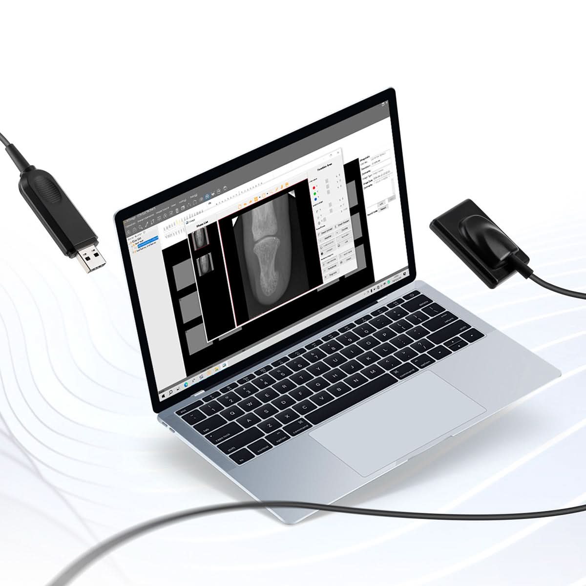 Dental Intraoral X-Ray Sensor Digital HD Image System Size 2 - pairaydental.com