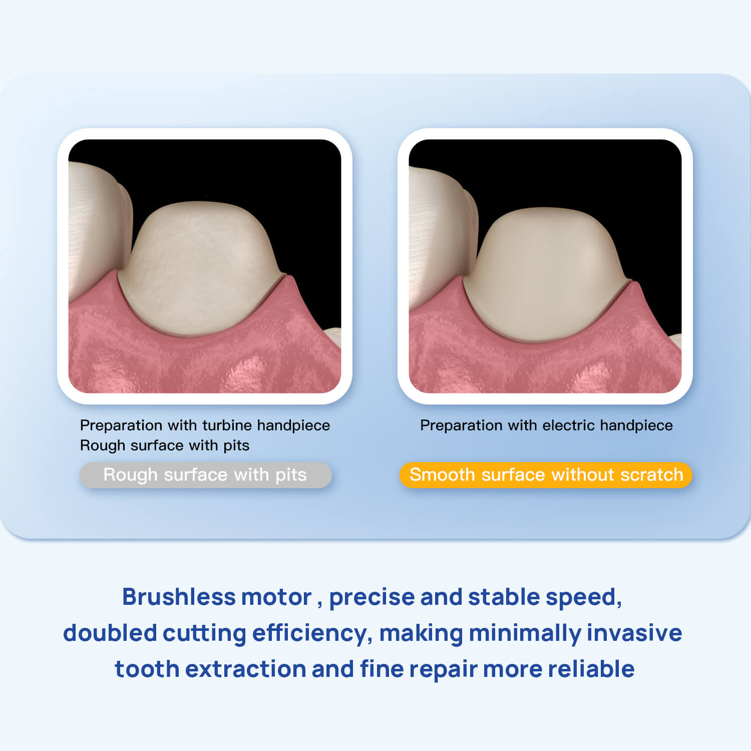 Dental LED Electric Brushless Surgery Micro Motor System & 1:1/1:5/1:4.2 Handpiece - pairaydental.com