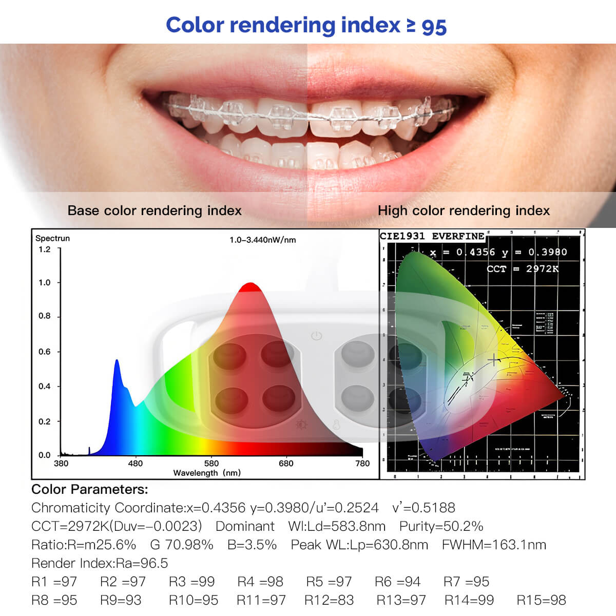 Dental Unit Chair LED Oral Light 8 Lights 10W 5-level Dual-Color Adjustable - pairaydental.com