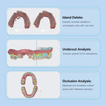 Dental Digital Impression Intraoral 3D Scanner Scanning Real Color CAD/CAM Software System - pairaydental.com