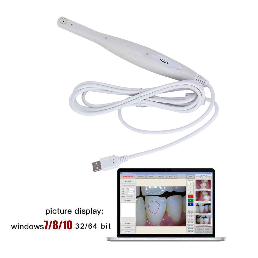Dental Intraoral Camera 8 LED Light Endoscope USB 1/4 Sensor - pairaydental.com