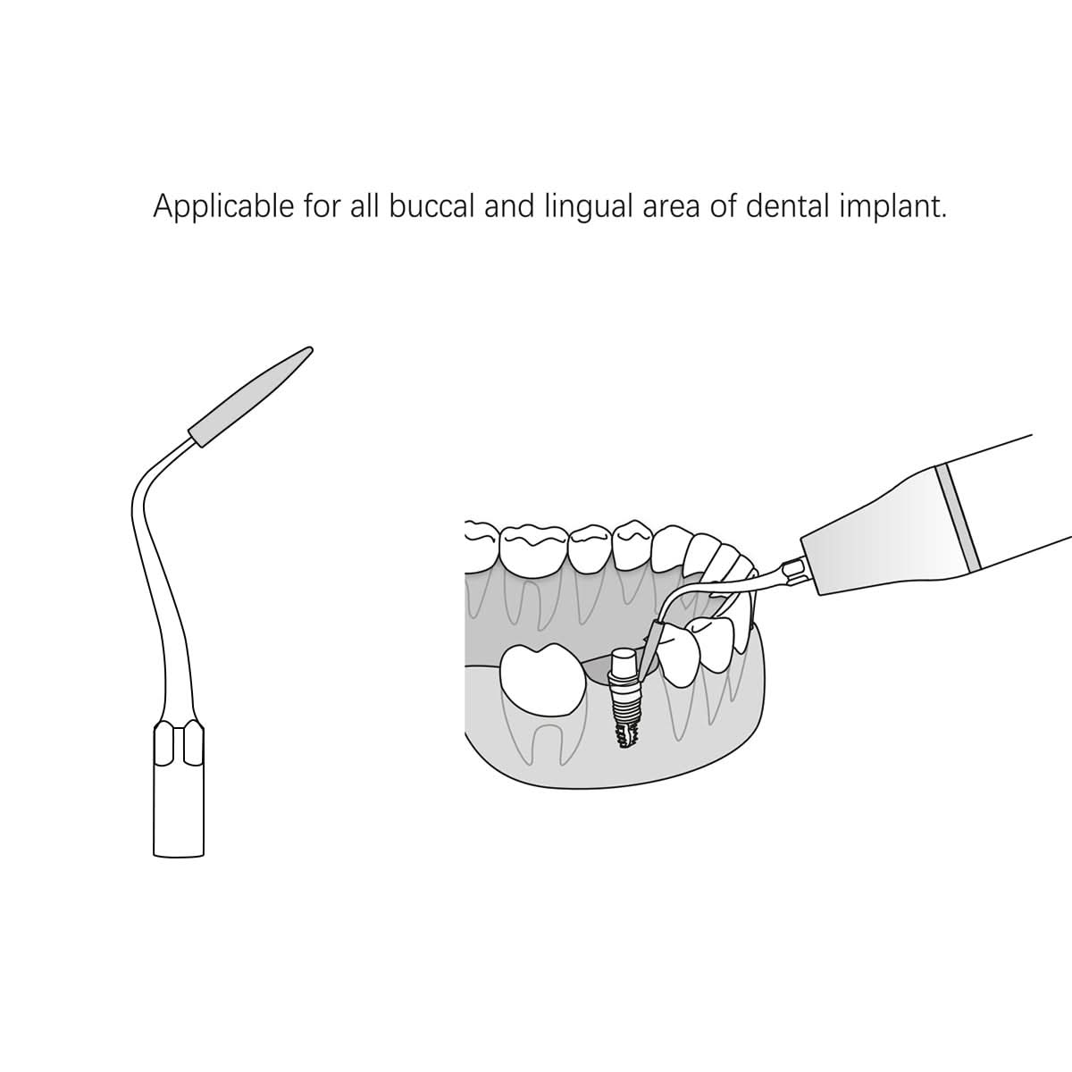 P90 Ultrasonic Scaler Tips Periodontal Implant Cleaning Tip - pairaydental.com