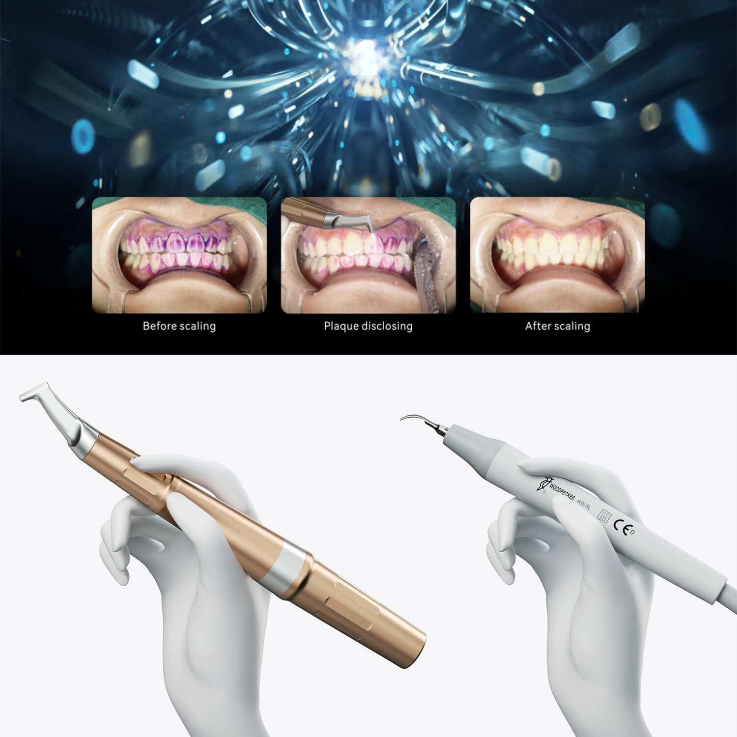 Woodpecker AP-B Dental 2 IN 1 Ultrasonic Scaler and Air Polisher System - pairaydental.com