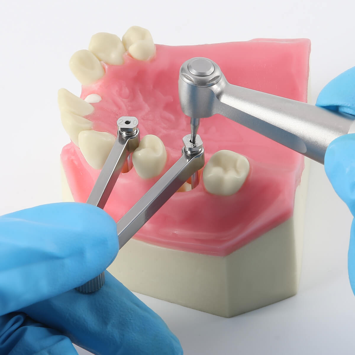 Dental Implant Position Locator Stainless Steel - pairaydental.com
