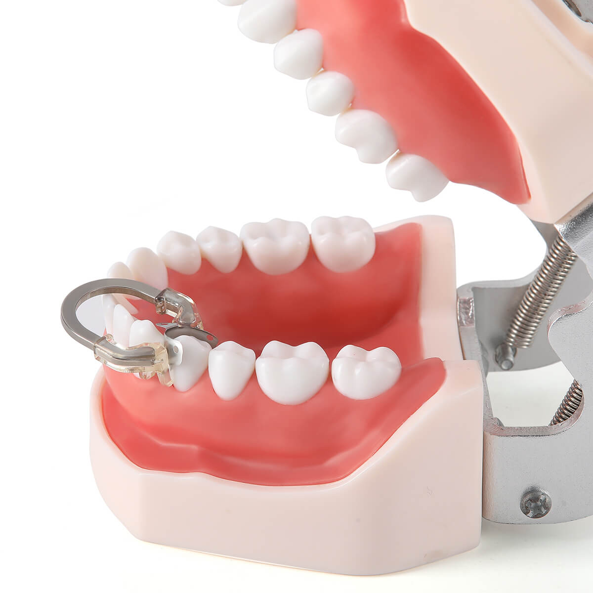 Dental Sectional Matrix Ring NITI Nickel Titanium deep Clamping Ring - pairaydental.com