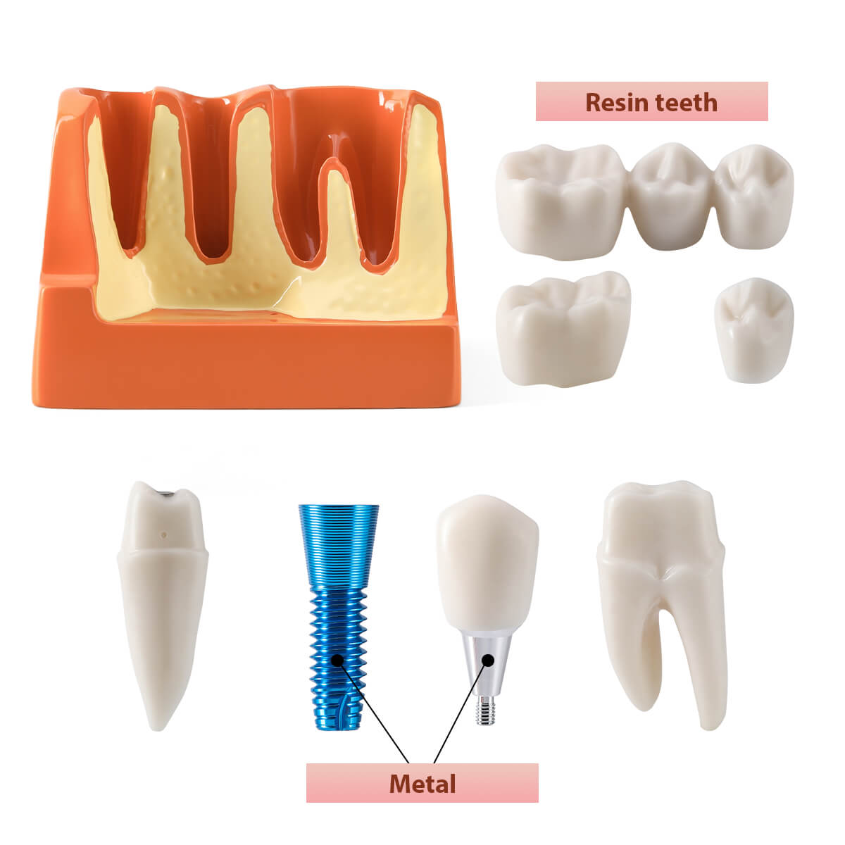 Dental 4 Times Teeth Model Implant Analysis Crown Bridge Demonstration Removable Model - pairaydental.com