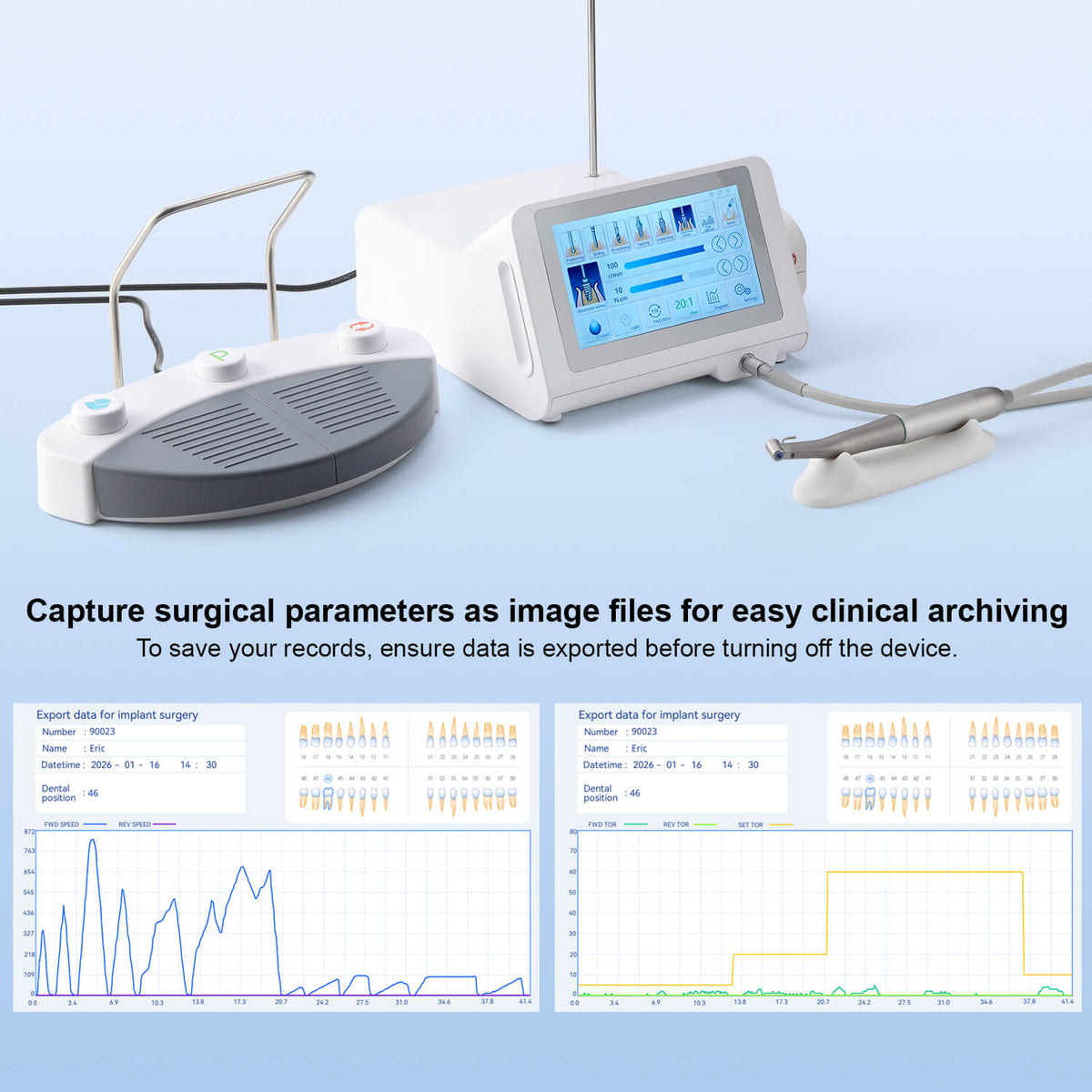 Dental Surgical Implant Motor Touch Screen With 20:1 Fiber Optic Contra Angle Handpiece - pairaydental.com