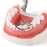 Dental Sectional Matrix Ring NITI Nickel Titanium deep Clamping Ring - pairaydental.com