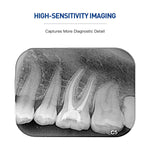 Dental Imaging Phosphor Plate Size 2# for Digital X-ray - pairaydental.com