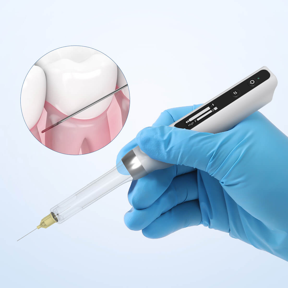 Dental Painless Oral Local Anesthesia Mini Anesthetic Device - pairaydental.com