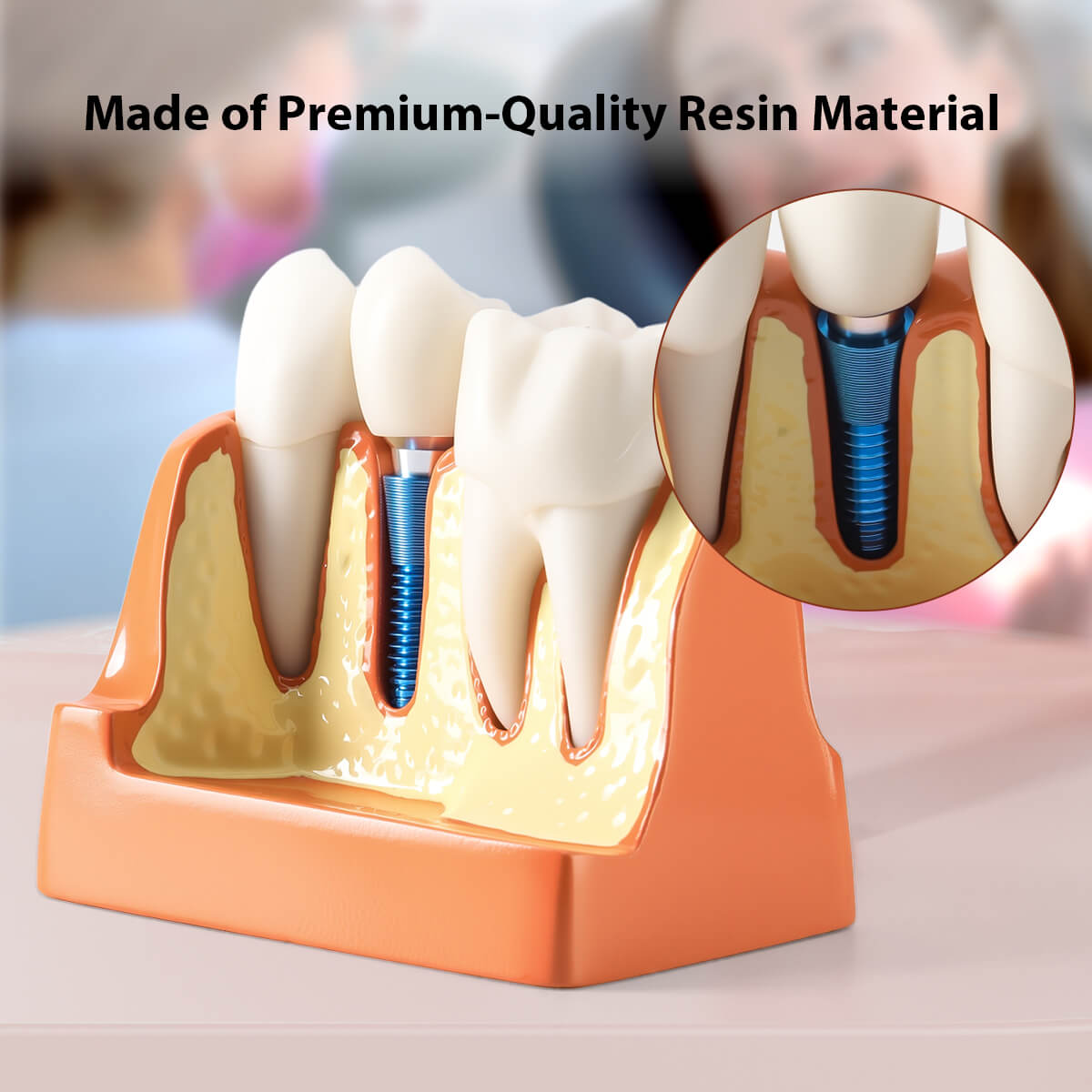 Dental 4 Times Teeth Model Implant Analysis Crown Bridge Demonstration Removable Model - pairaydental.com