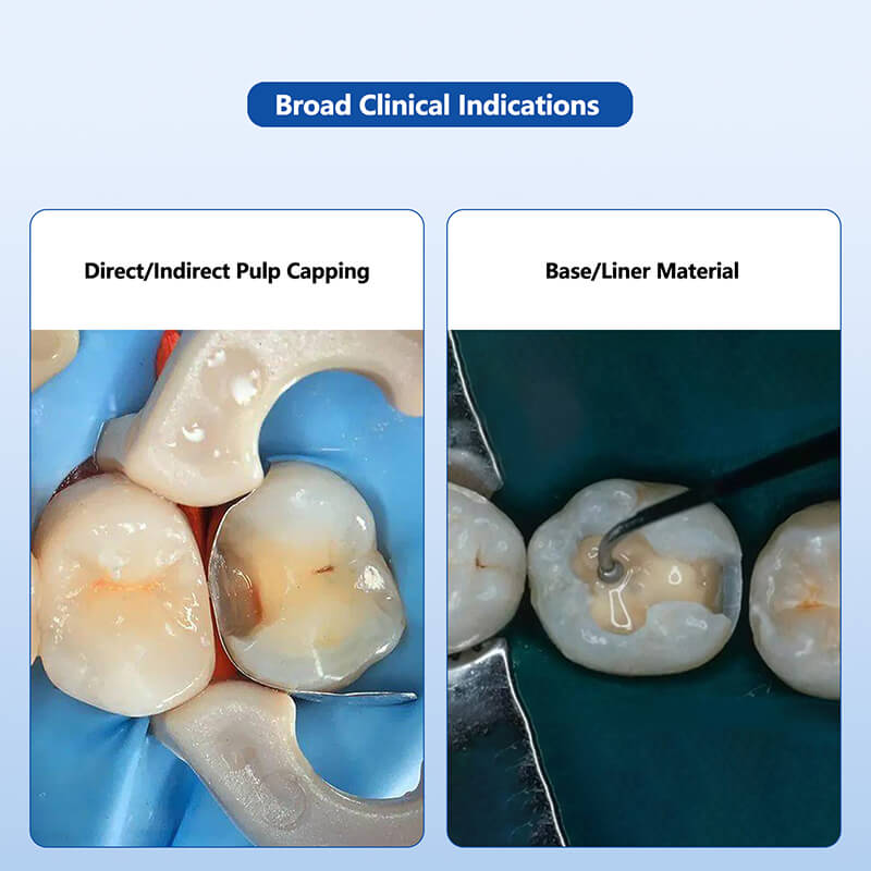 Dental Light-Cured Radiopaque Calcium Hydroxide Paste Cavity Liner Pulp Capping - pairaydental.com