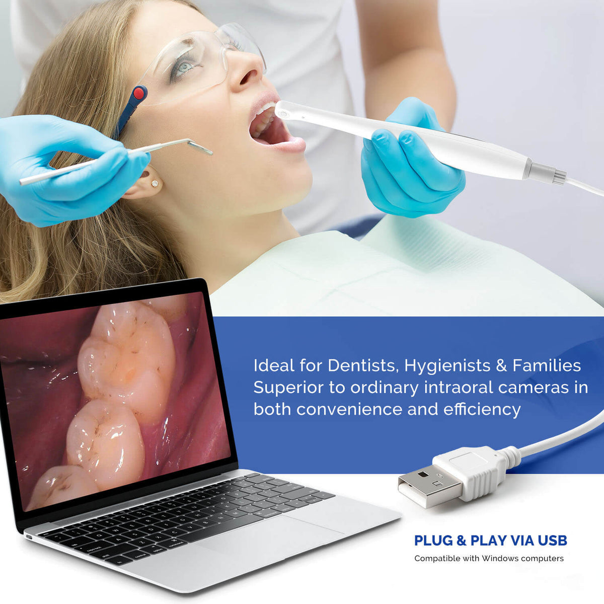 Dental Intraoral Camera HD USB Digital 6 LED Lights 2.0MP High Pixel - pairaydental.com