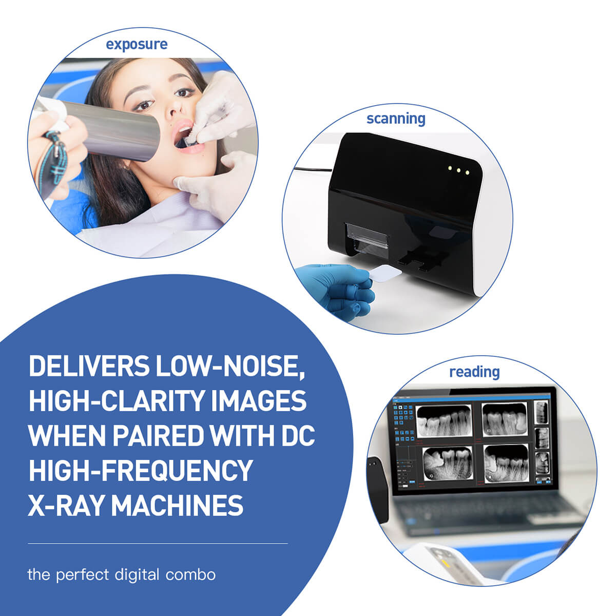 Dental Imaging Phosphor Plate Size 2# for Digital X-ray - pairaydental.com