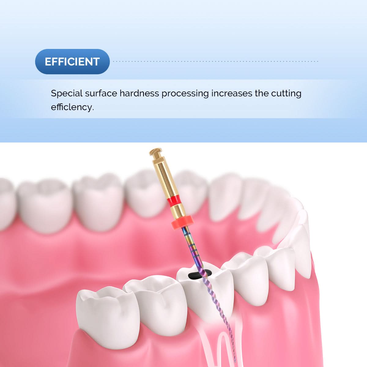 Dental Rotary Engine Super Files Rainbow NiTi Files Thermal Activation 25mm 6pcs/Pack - pairaydental.com