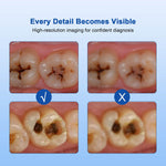 Dental Intraoral Camera HD USB Digital 8 LED Lights 4K Mega Pixels Imaging Software - pairaydental.com