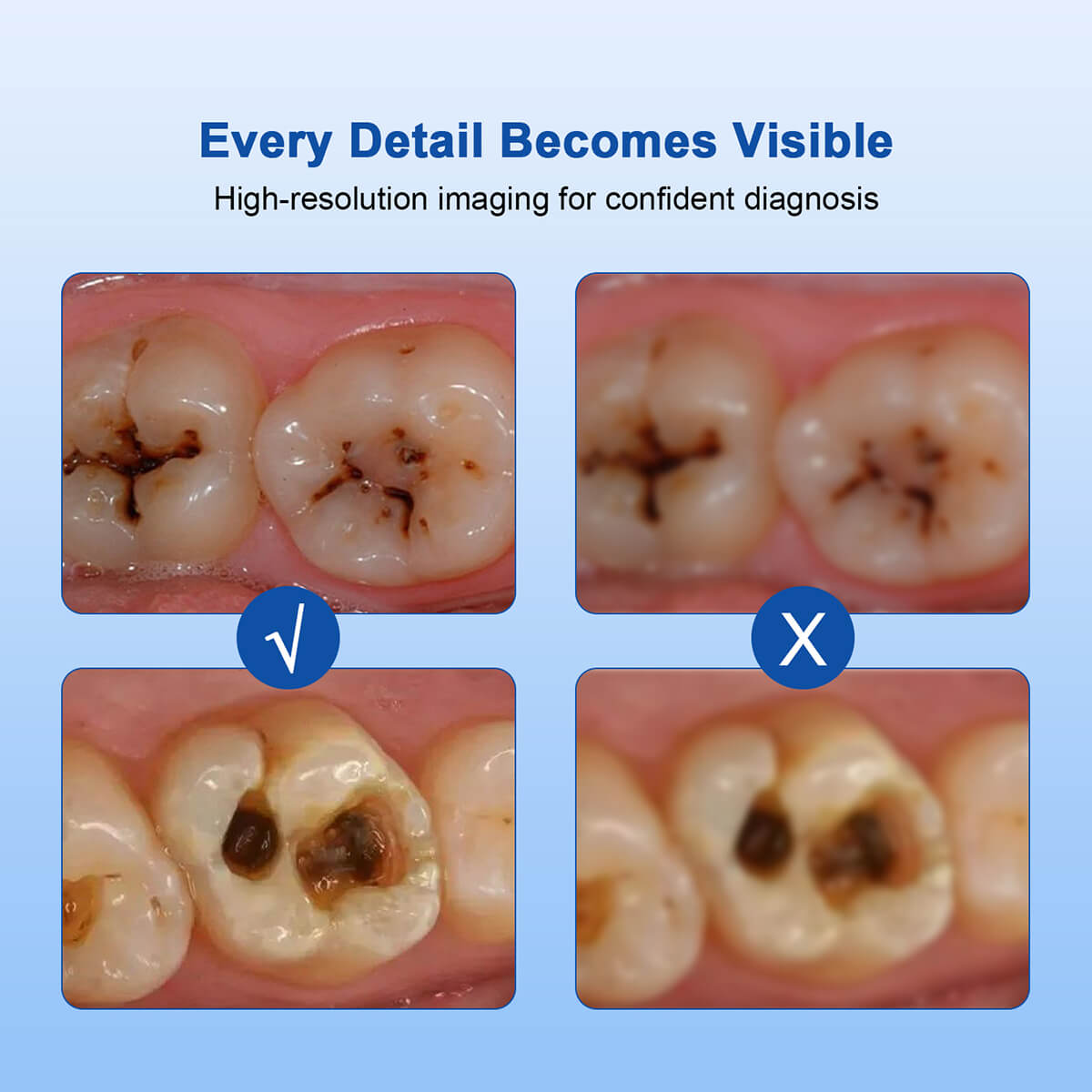 Dental Intraoral Camera HD USB Digital 8 LED Lights 4K Mega Pixels Imaging Software - pairaydental.com