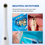 Dental Intraoral Camera 6pcs Cold Lights Digital Oral Endoscope Auto-focus - pairaydental.com