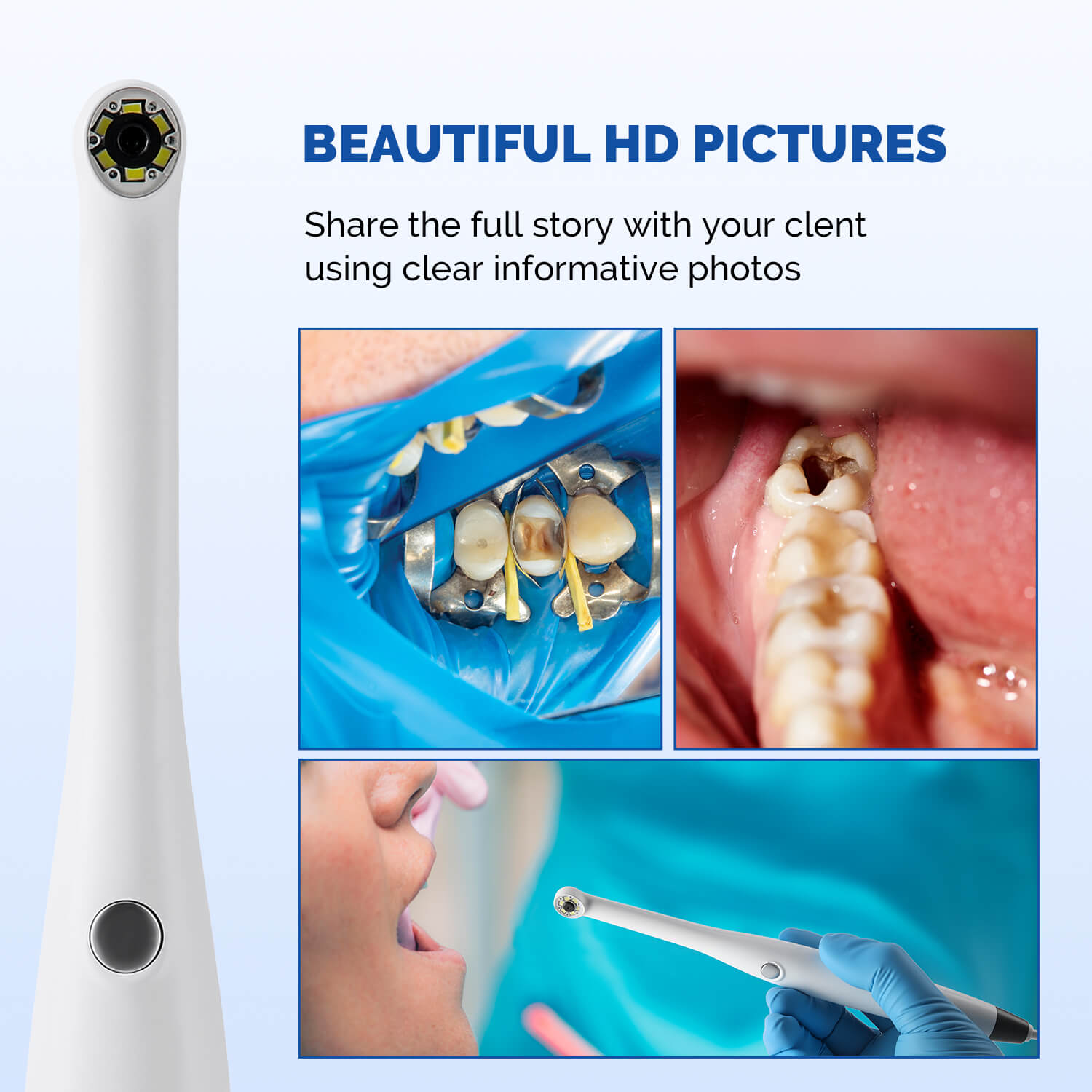 Dental Intraoral Camera 6pcs Cold Lights Digital Oral Endoscope Auto-focus - pairaydental.com