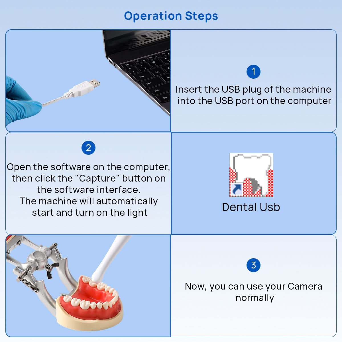 Dental Intraoral Camera USB Digital Imaging Endoscope 6-LED Light - pairaydental.com