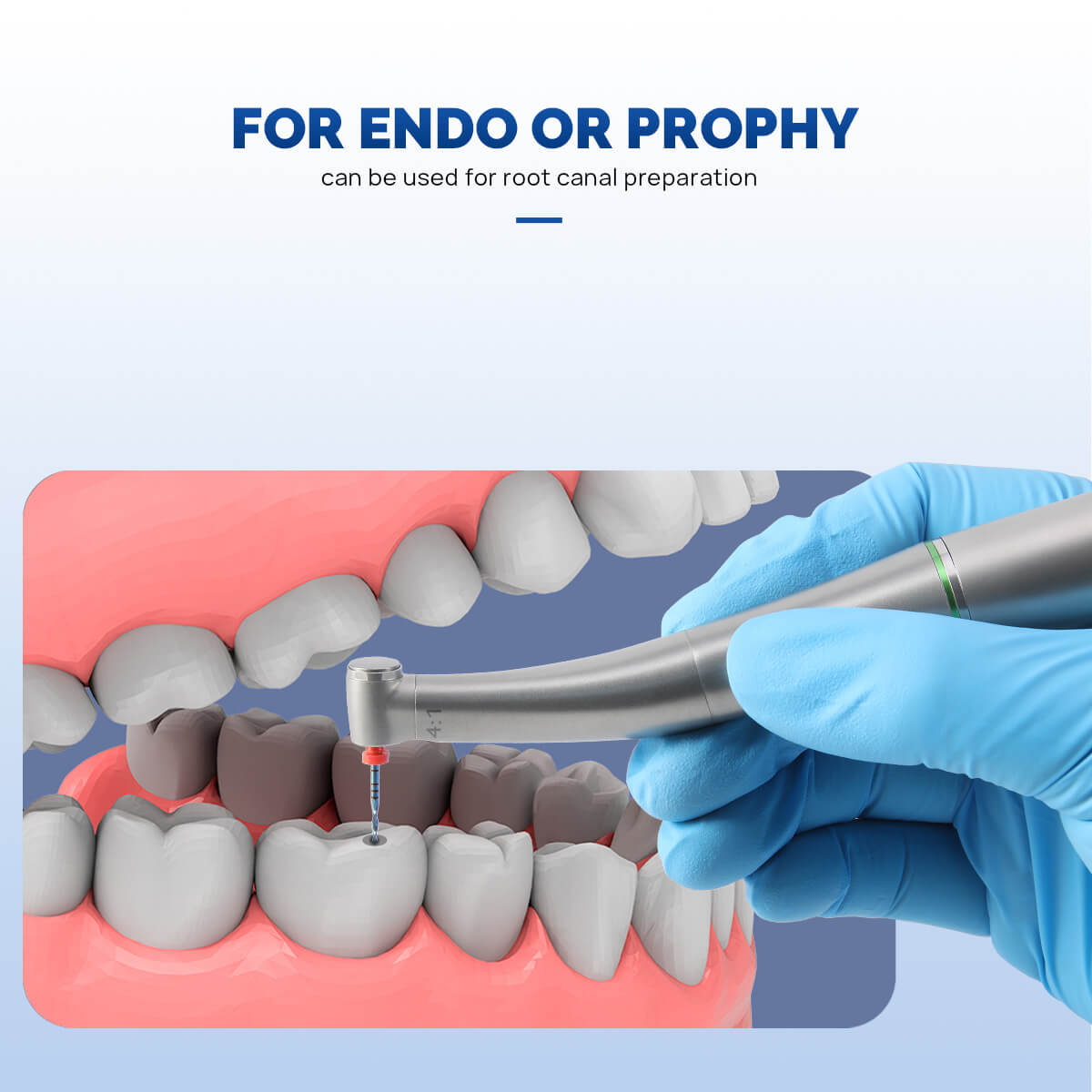 4:1 Fiber Optic Contra Angle Handpiece Mini Head Internal Channel Quattro Spray - pairaydental.com