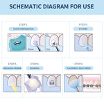 Light Cure Orthodontic Adhesive Kit Bonding Bracket Syringes 1pcs 3.5g - pairaydental.com