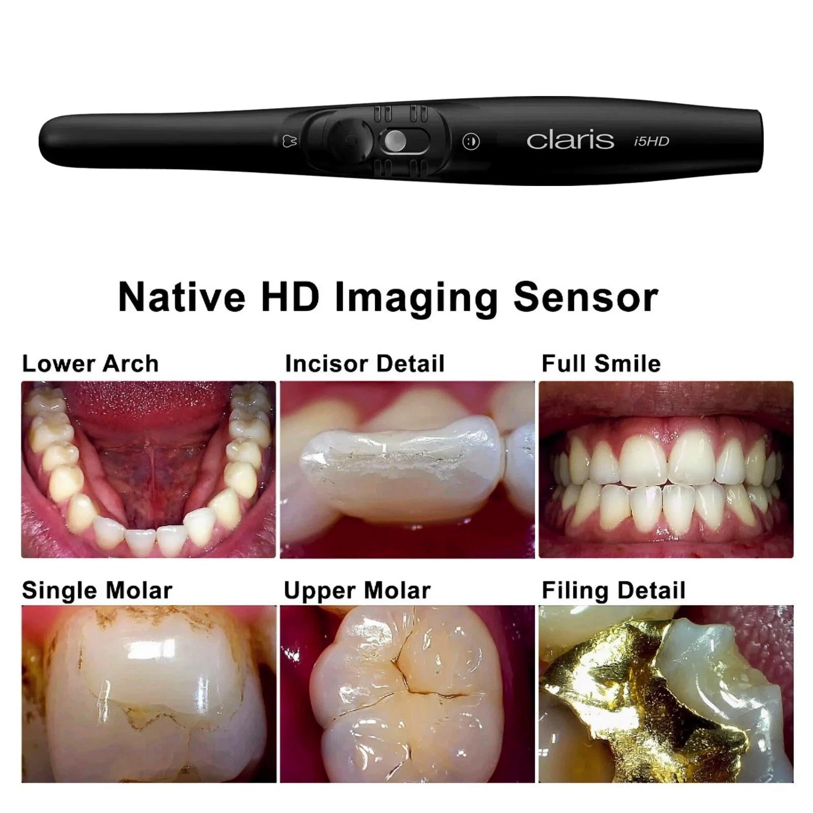 SOTA Imaging® Claris i5HD Intraoral Camera - pairaydental.com