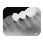 Apixia Digital PSP Scanner System with Phosphor Plates (#2×12) - pairaydental.com
