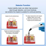 Dental Implant Stability Monitor ISQ Tester for Osseointegration Measurement - pairaydental.com
