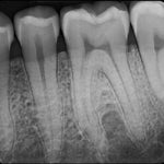 SOTA Imaging® Clio Pedo Digital X-Ray Sensor #A30052 - pairaydental.com