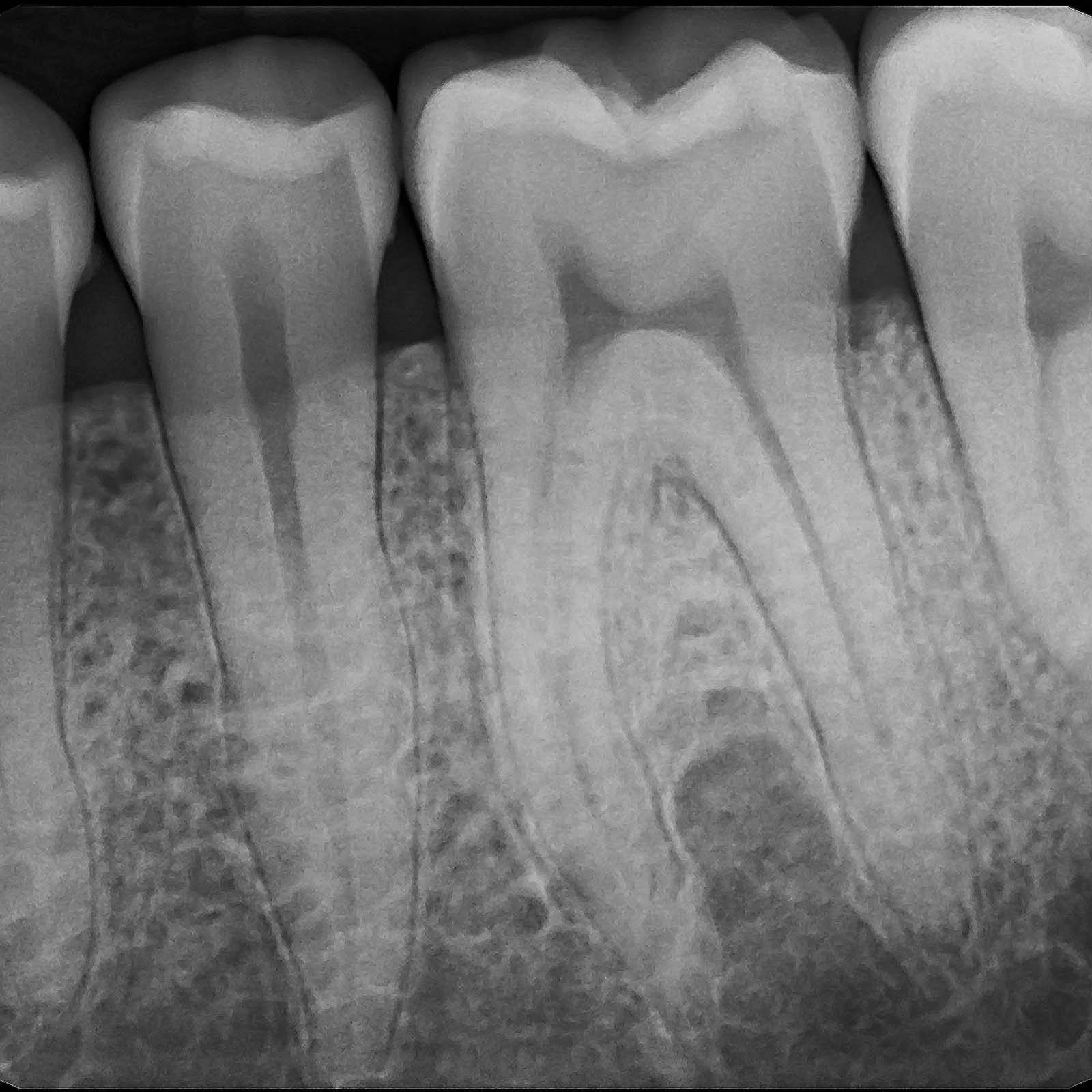 SOTA Imaging® Clio Pedo Digital X-Ray Sensor #A30052 - pairaydental.com