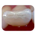 SOTA Imaging® Claris i5HD Intraoral Camera - pairaydental.com