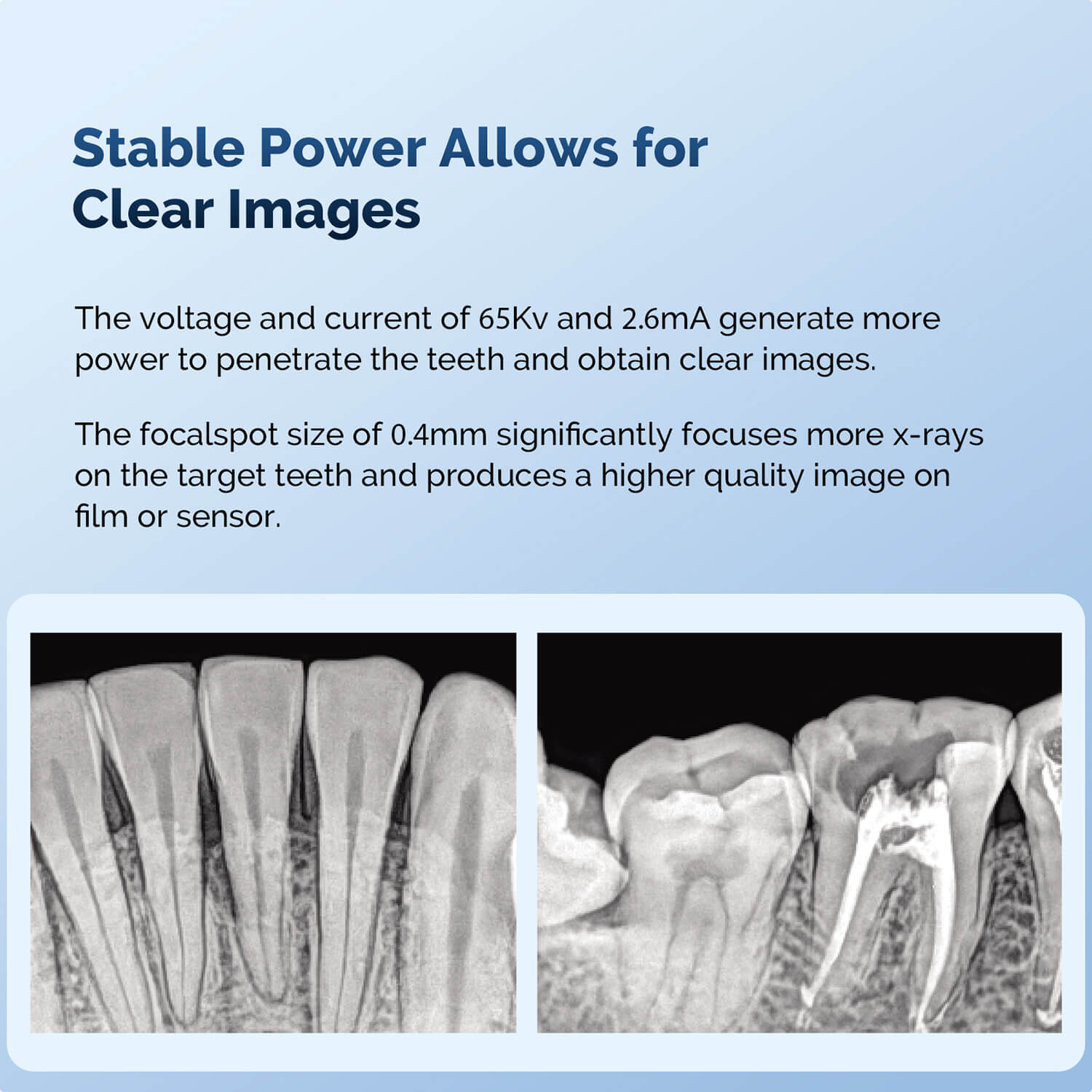 Dental Portable X-Ray Machine Handheld Digital Smart Touch Screen Control With Scatter Shield - pairaydental.com