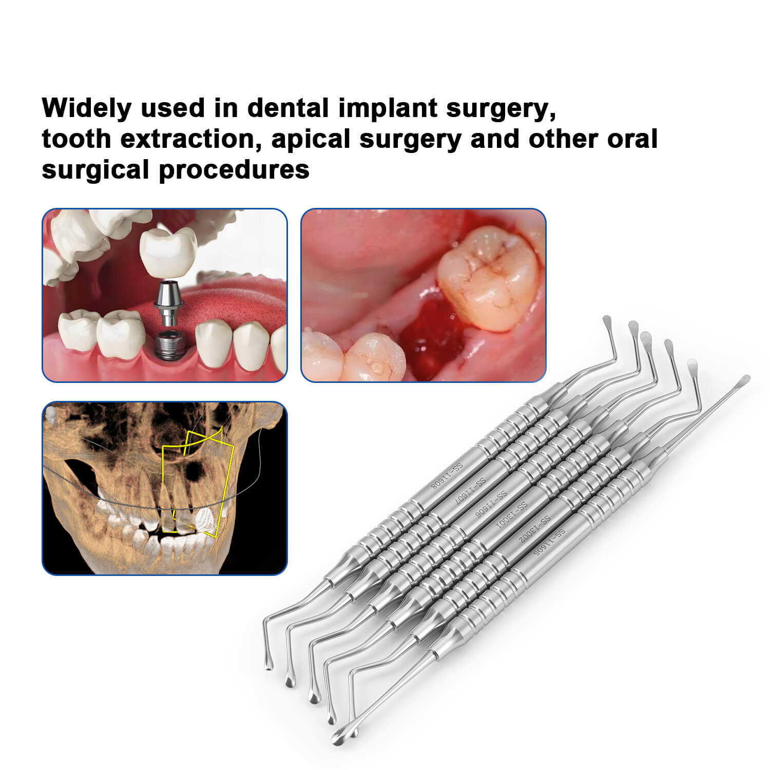 Dental Bone Curette Lucas Surgical Curettes with Smooth/Serrated Tip - pairaydental.com
