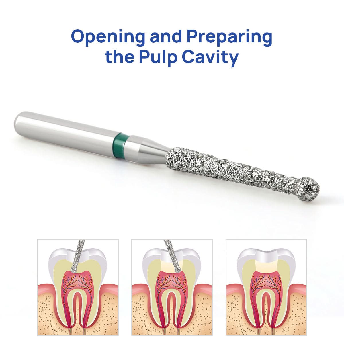 Dental Diamond Endo Bur FG Round Opening Preparing the Pulp Cavity 5pcs/Pack - pairaydental.com