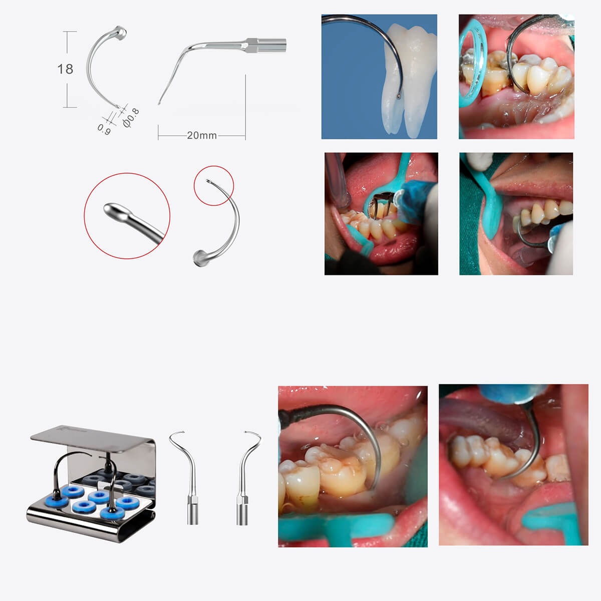 Woodpecker PT3 Painless Periodontal Treatment Device Ultrasonic Scaler Automatic Water Supply System with Titanium Tips - pairaydental.com
