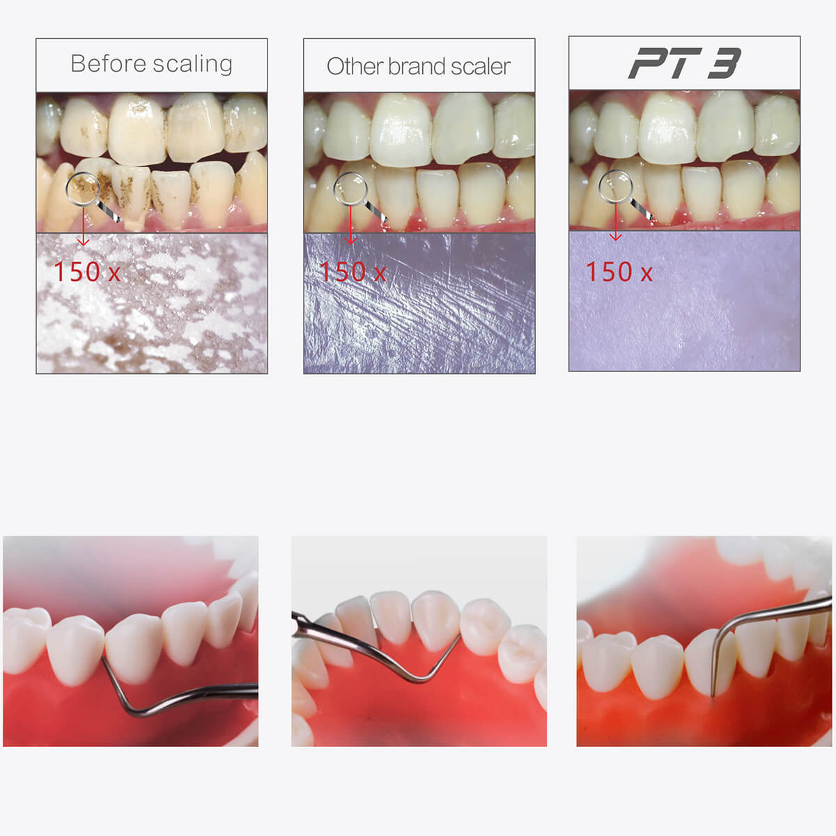 Woodpecker PT3 Painless Periodontal Treatment Device Ultrasonic Scaler Automatic Water Supply System with Titanium Tips - pairaydental.com